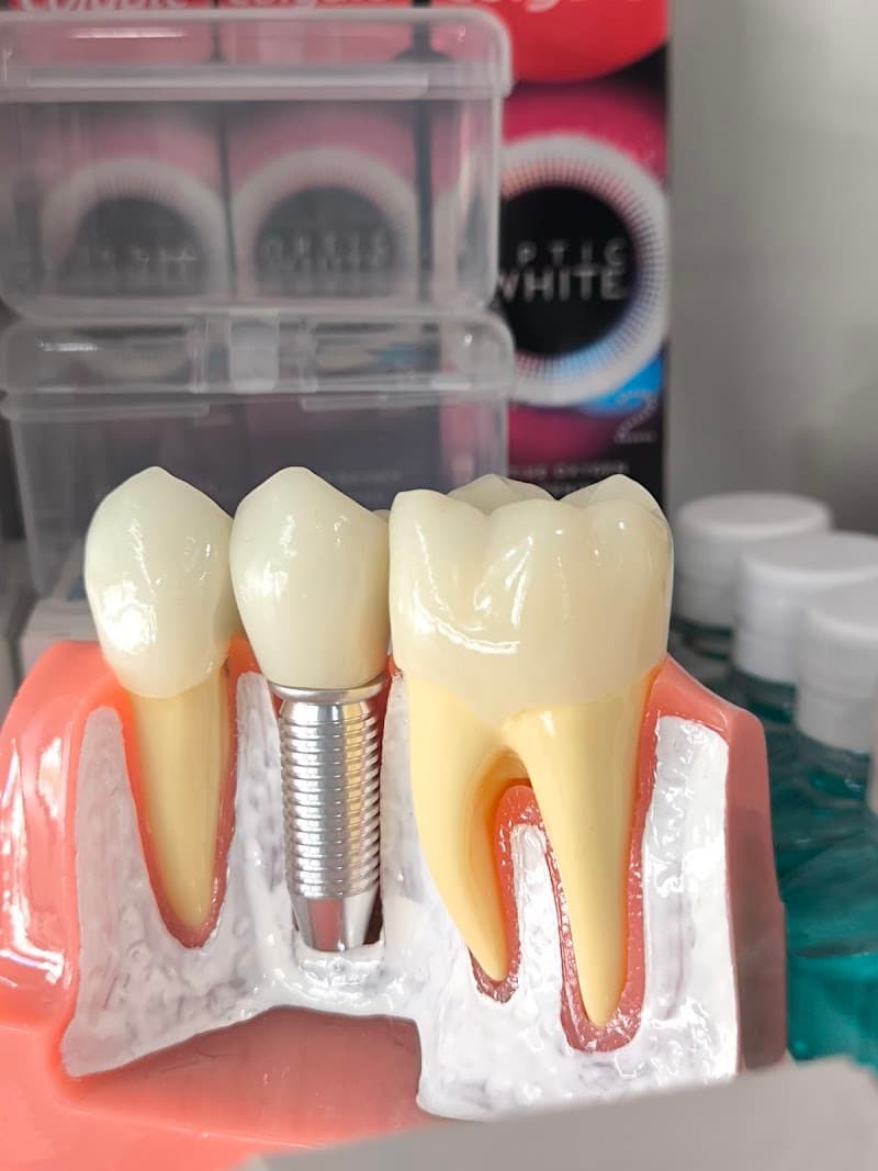 Spark Dental Clinic🦷🔧 : คลินิกทันตกรรม สปาร์ก- (ศูนย์รากฟันเทียม จัดฟันใส และวีเนียร์ ) - ตลาดโบ๊เบ๊ คลองมหานาค